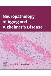 Neuropathology of Aging and Alzheimer’s Disease - Humanitas