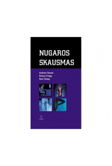 Nugaros skausmas - Humanitas