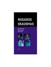 Nugaros skausmas - Humanitas