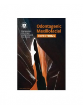 Odontogenic MaxillofacialInfections - Humanitas