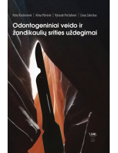 Odontogeniniai veido ir žandikaulių srities uždegimai - Humanitas