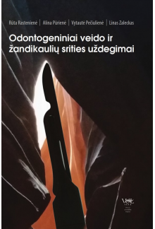 Odontogeniniai veido ir žandikaulių srities uždegimai - Humanitas