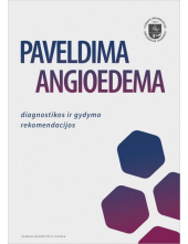 Paveldima angioedema: diagnostikos ir gydymo rekomendacijos - Humanitas