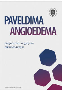 Paveldima angioedema: diagnostikos ir gydymo rekomendacijos - Humanitas