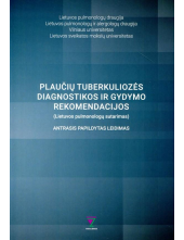 Plaučių tuberkuliozės diagnostikos ir gydymo rekomendacijos - Humanitas