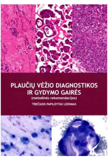 Plaučių vėžio diagnostikos ir gydymo gairės - Humanitas
