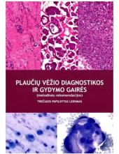 Plaučių vėžio diagnostikos ir gydymo gairės - Humanitas