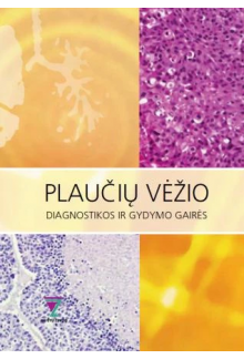 Plaučių vėžio diagnostikos ir gydymo gairės - Humanitas