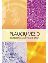 Plaučių vėžio diagnostikos ir gydymo gairės - Humanitas