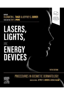Procedures in Cosmetic Dermatology: Lasers, Lights, and Energy Devices - Humanitas