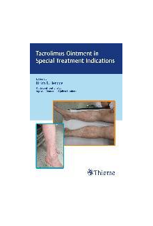 Tacrolimus Ointment in Special Treatment Indications - Humanitas