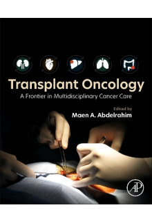 Transplant Oncology - Humanitas