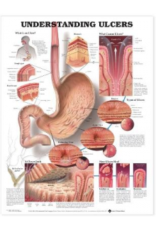 Understanding Ulcers Anatomica l Chart - Humanitas