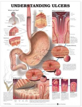 Understanding Ulcers Anatomica l Chart - Humanitas