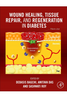 Wound Healing, Tissue Repair, and Regeneration in Diabetes - Humanitas